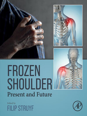 cover image of Frozen Shoulder